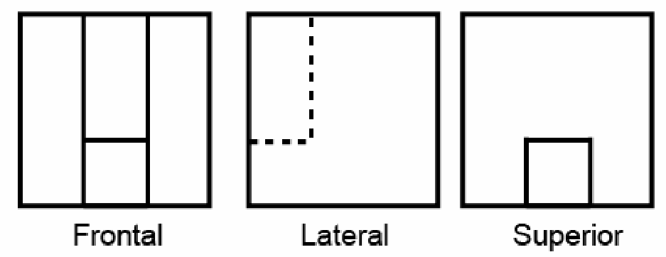 Alternativa A