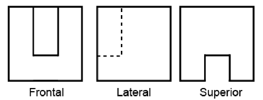 Alternativa B