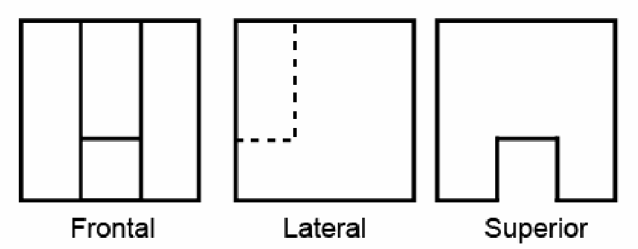 Alternativa D
