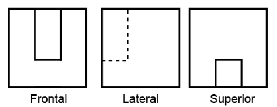 Alternativa E
